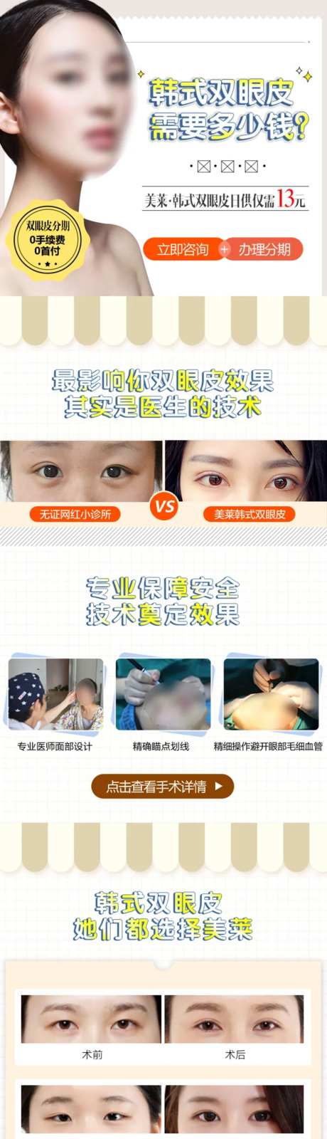 医美韩式双眼皮详情页-采灵感-https://www.cailinggan.com/
