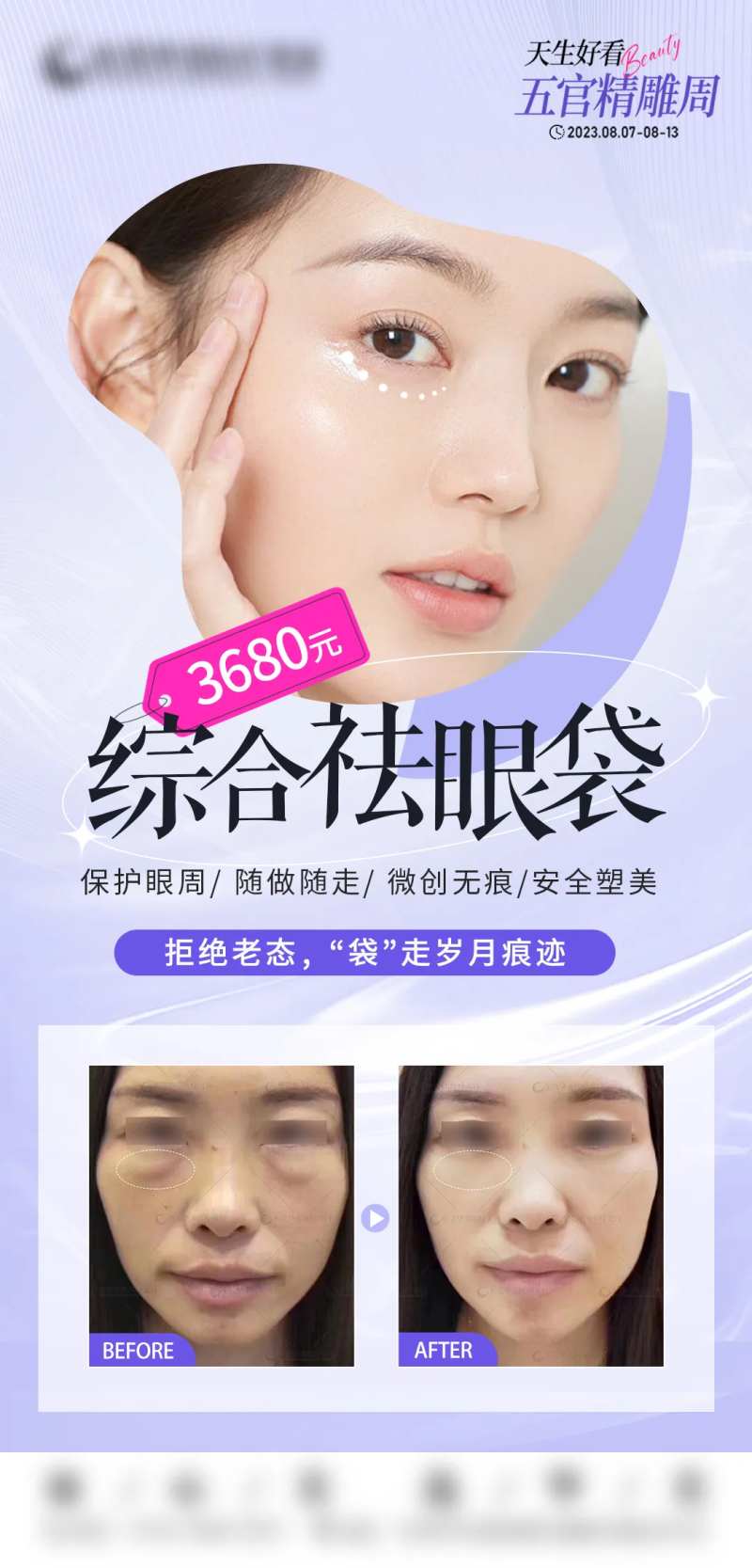 综合祛眼袋-采灵感-cailinggan.com