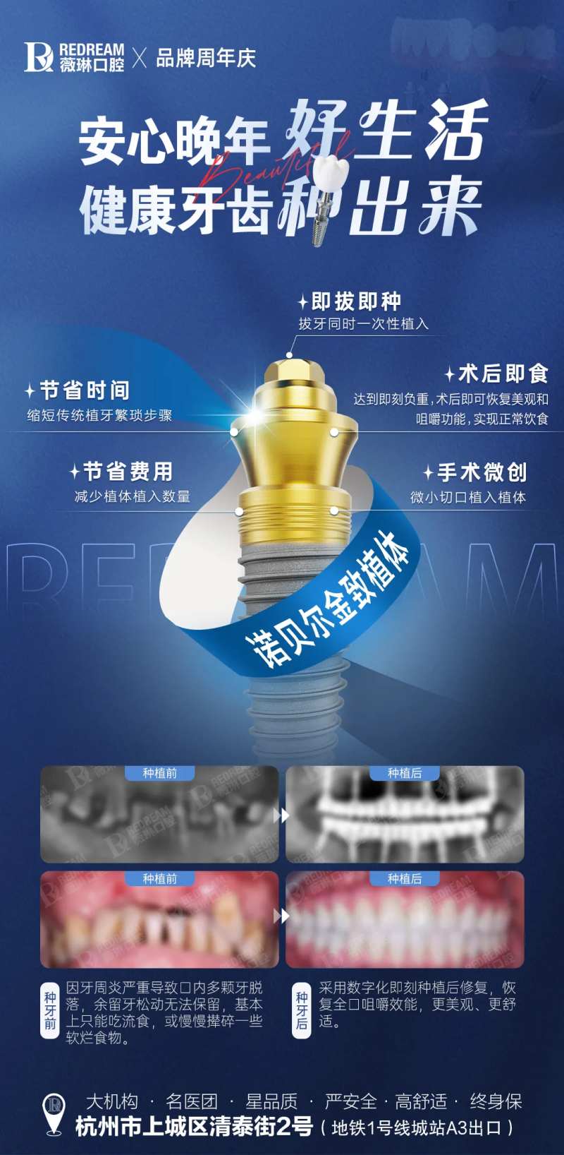 种植牙技术海报-采灵感-cailinggan.com