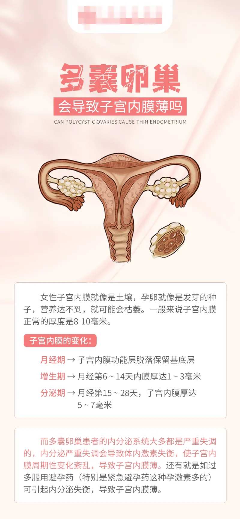 多囊卵巢会导致子宫内膜薄海报-采灵感-cailinggan.com