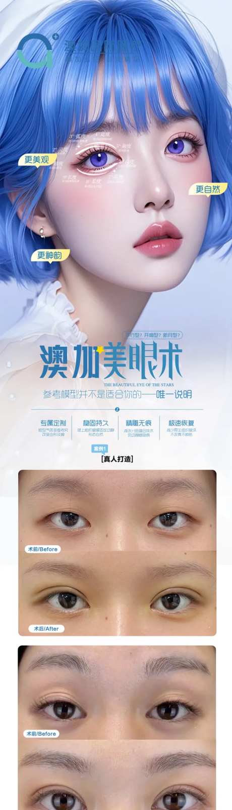 眼综合案例-采灵感-https://www.cailinggan.com/