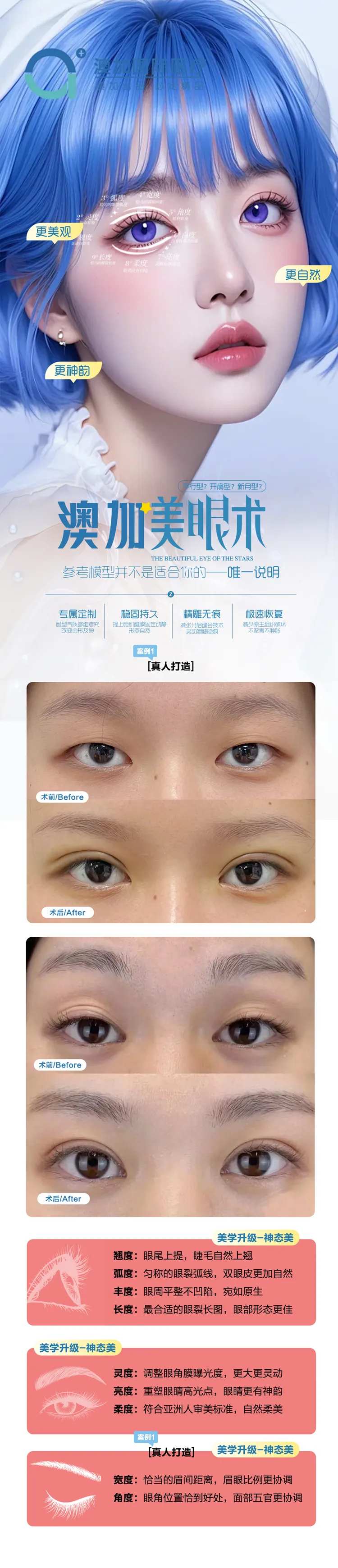 眼综合案例-采灵感-cailinggan.com