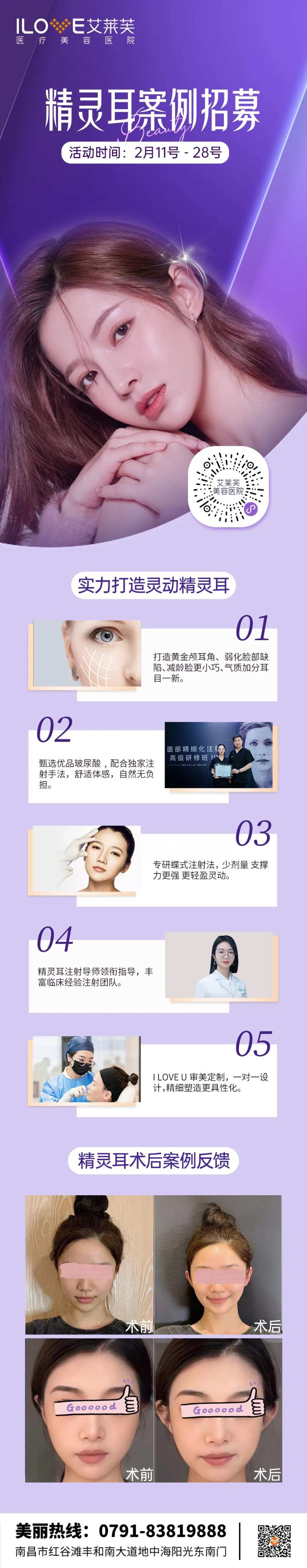 医美精灵耳体验官案例招募-采灵感-cailinggan.com