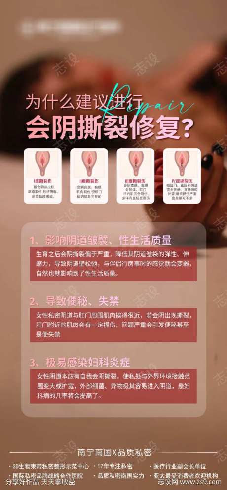 会阴撕裂修复-采灵感-https://www.cailinggan.com/