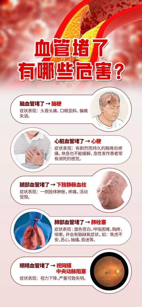 血管堵了有那些危害宣传海报-采灵感-https://www.cailinggan.com/