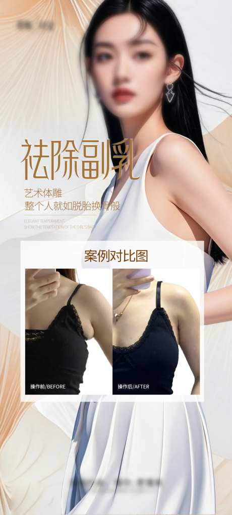 副乳吸脂案例海报-采灵感-https://www.cailinggan.com/