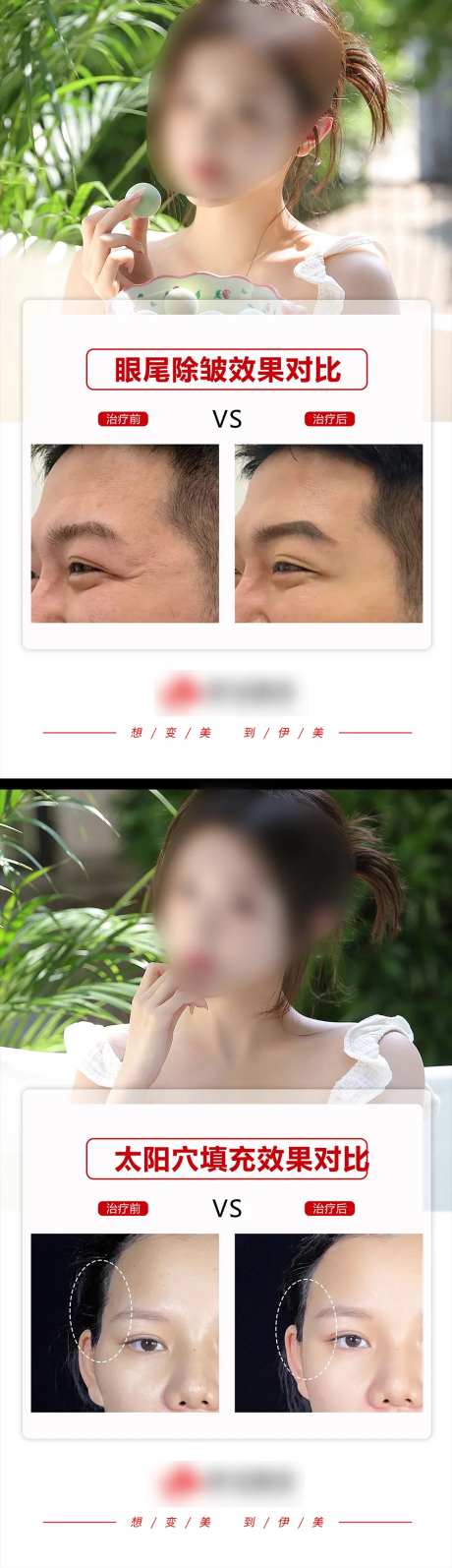 医美案例对比模版海报-采灵感-https://www.cailinggan.com/