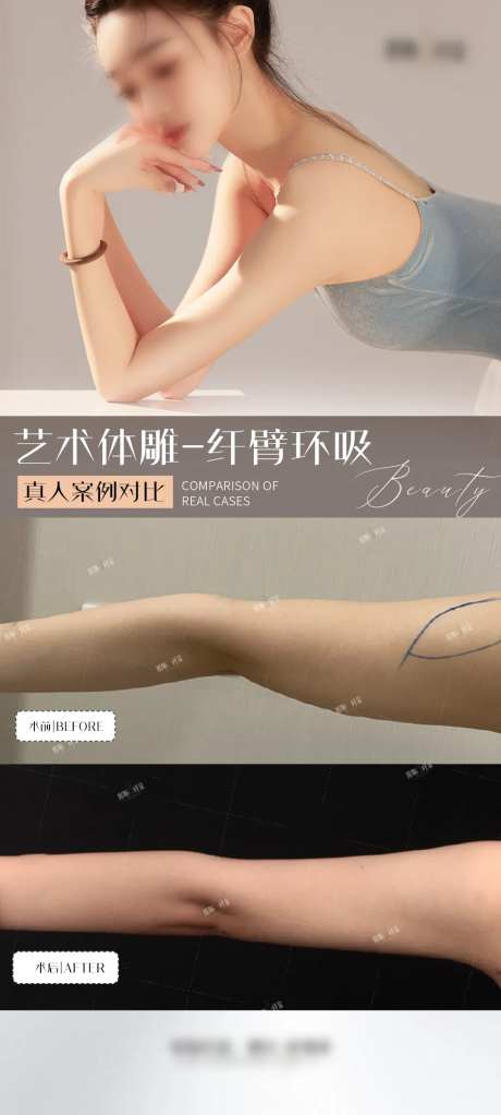纤细手臂案例海报-采灵感-https://www.cailinggan.com/