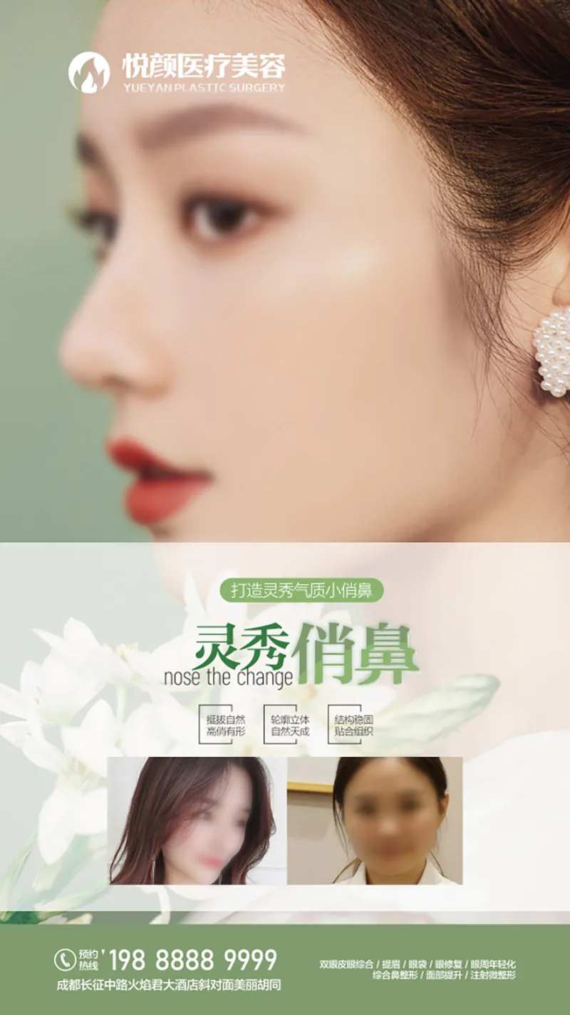 医美隆鼻假体海报-采灵感-cailinggan.com