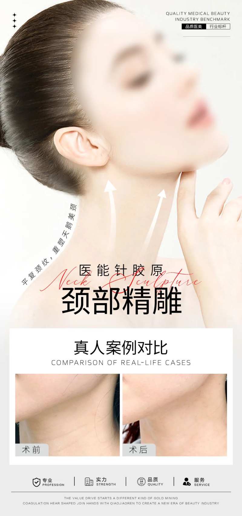 天鹅颈案例对比海报-采灵感-cailinggan.com