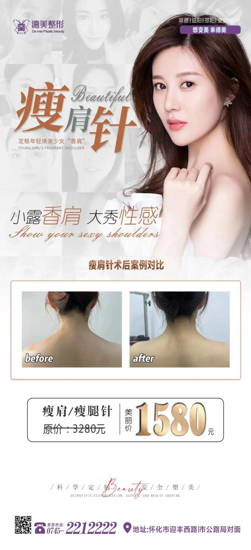 瘦脸 瘦肩针-采灵感-cailinggan.com