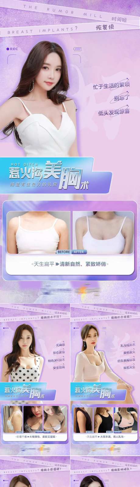 医美美胸术案例海报-采灵感-https://www.cailinggan.com/