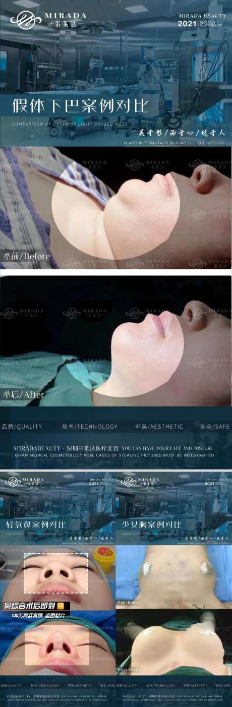 医美项目案例对比系列海报-采灵感-https://www.cailinggan.com/