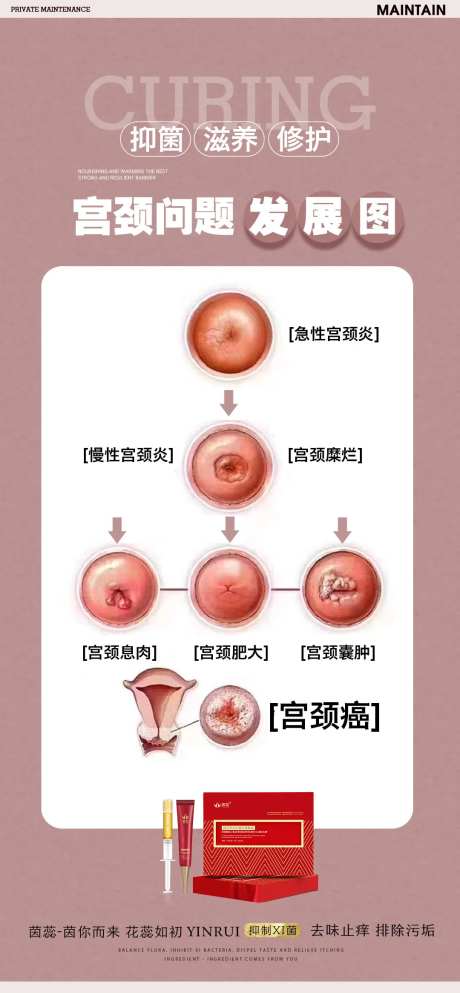 宫颈示意图-采灵感-https://www.cailinggan.com/