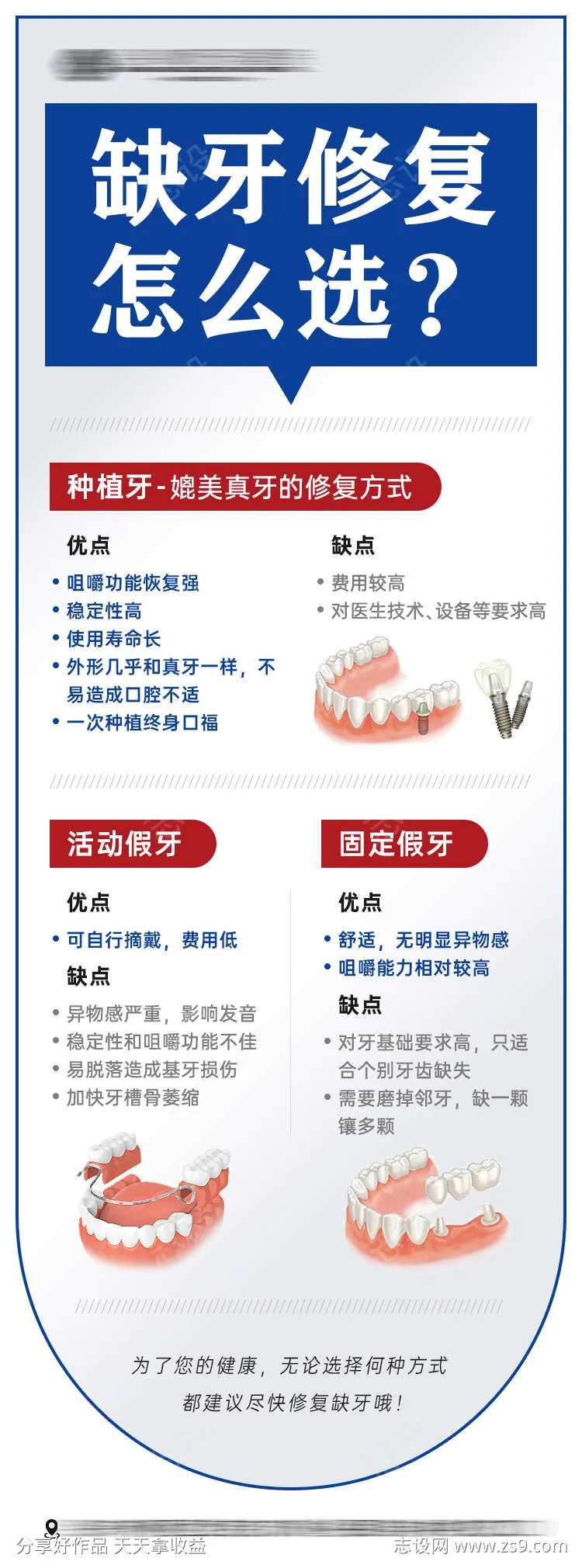 缺牙修复方式对比-采灵感-cailinggan.com