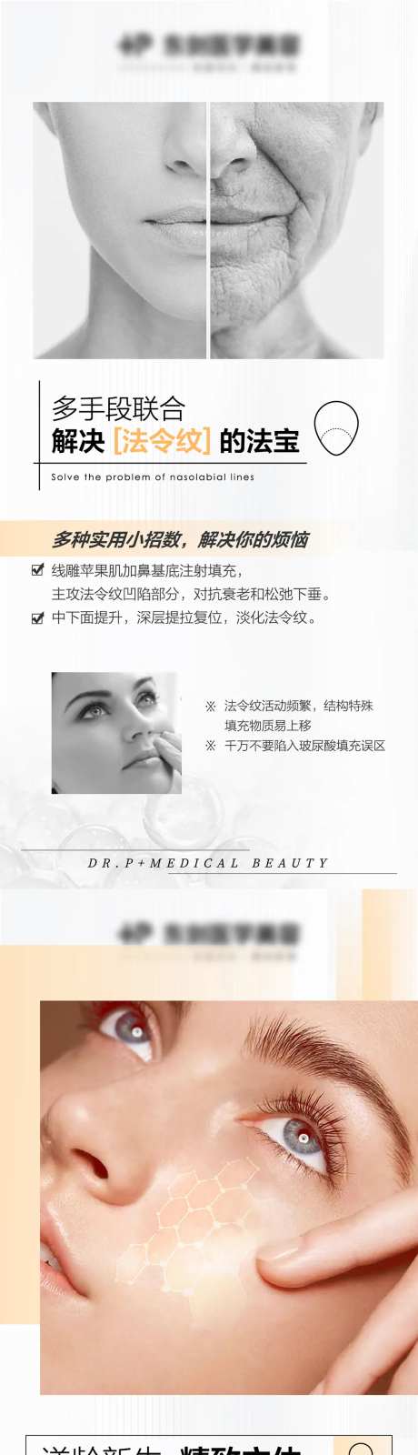 医美玻尿酸注射面部比例法令纹海报-采灵感-https://www.cailinggan.com/
