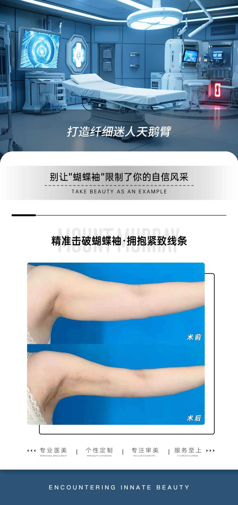 蝴蝶袖手臂吸脂案例对比海报-采灵感-cailinggan.com
