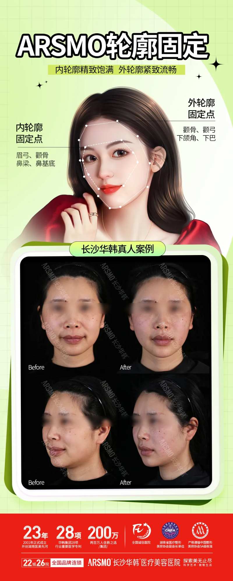 轮廓固定医美海报-采灵感-cailinggan.com