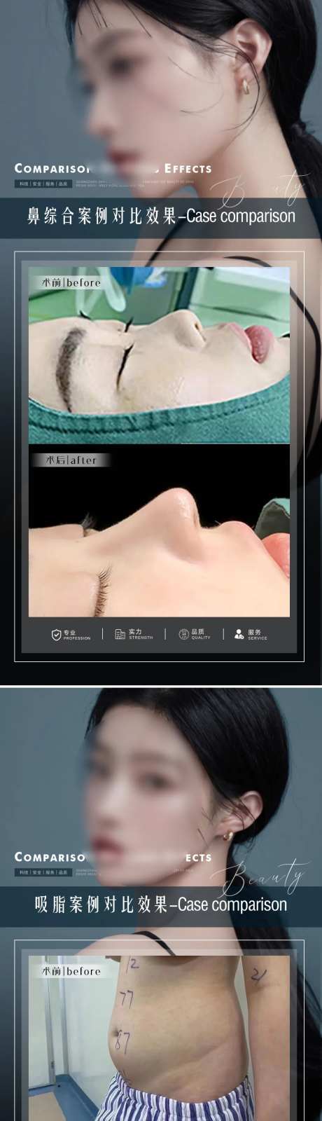 医美案例整形对比图-采灵感-https://www.cailinggan.com/