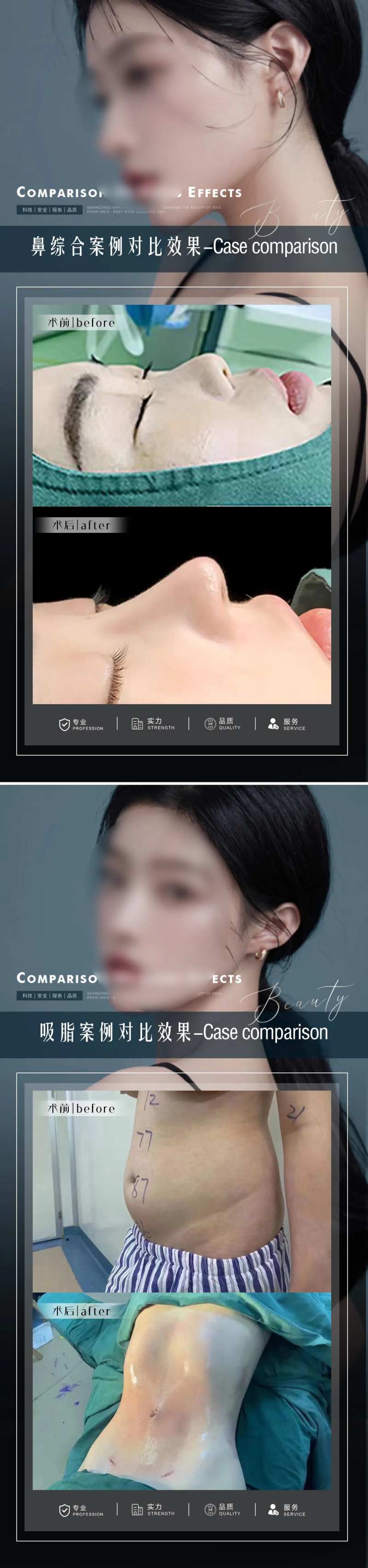 医美案例整形对比图-采灵感-cailinggan.com