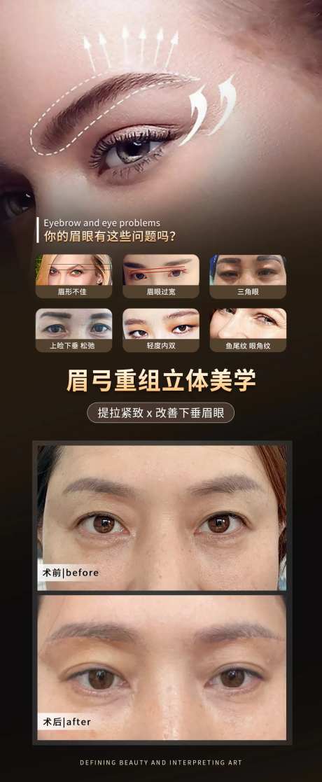 眉弓重组立体美学案例宣传海报-采灵感-https://www.cailinggan.com/