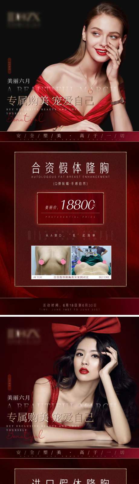 医美隆胸假体丰胸活动海报-采灵感-https://www.cailinggan.com/