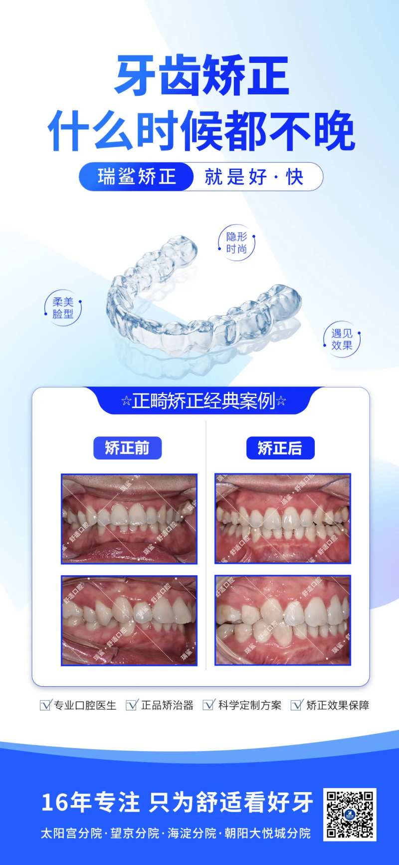 牙齿矫正案例-采灵感-cailinggan.com
