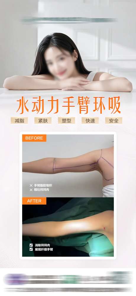 水动力手臂吸脂-采灵感-https://www.cailinggan.com/