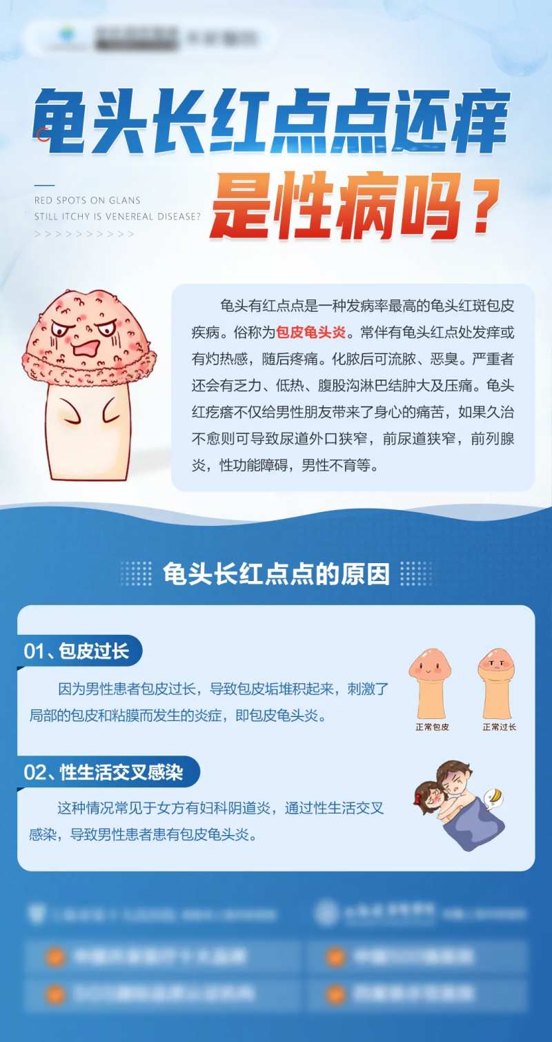 龟头长红点点还痒是性病吗-采灵感-cailinggan.com