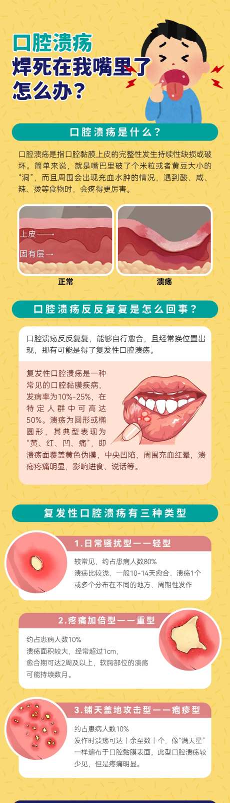 口腔溃疡科普长图-采灵感-https://www.cailinggan.com/