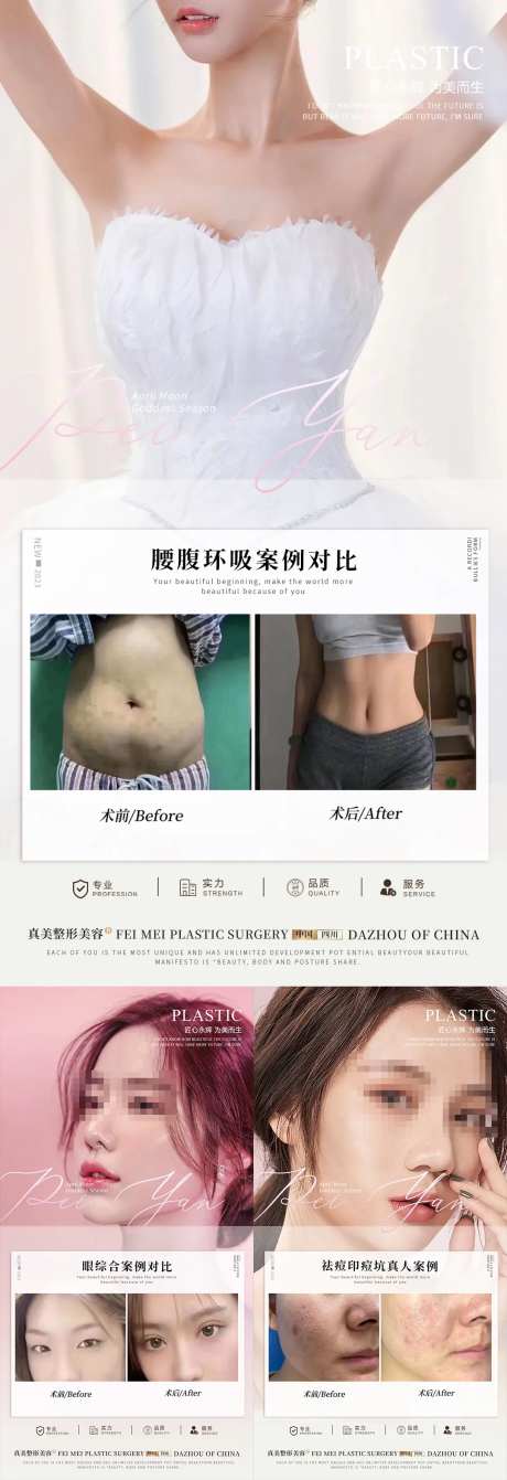 整形案例-采灵感-https://www.cailinggan.com/