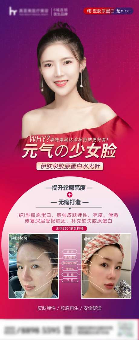 医美整形对比案例海报-采灵感-https://www.cailinggan.com/