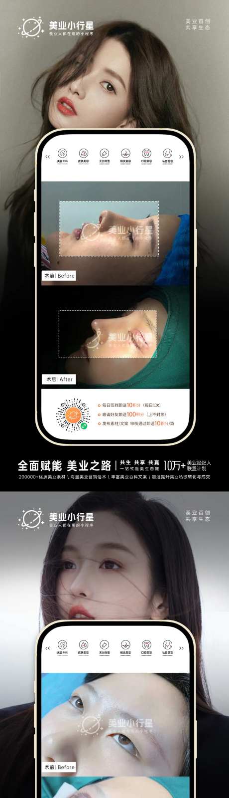 医美整形美容真人案例分享集-采灵感-https://www.cailinggan.com/