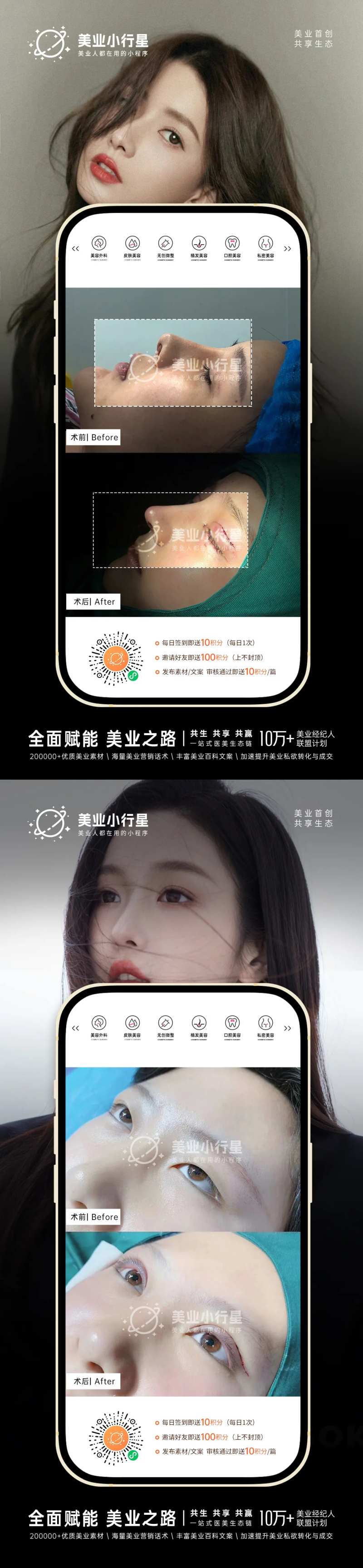 医美整形美容真人案例分享集-采灵感-cailinggan.com
