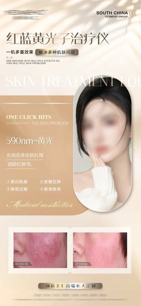 医美红蓝光-采灵感-https://www.cailinggan.com/