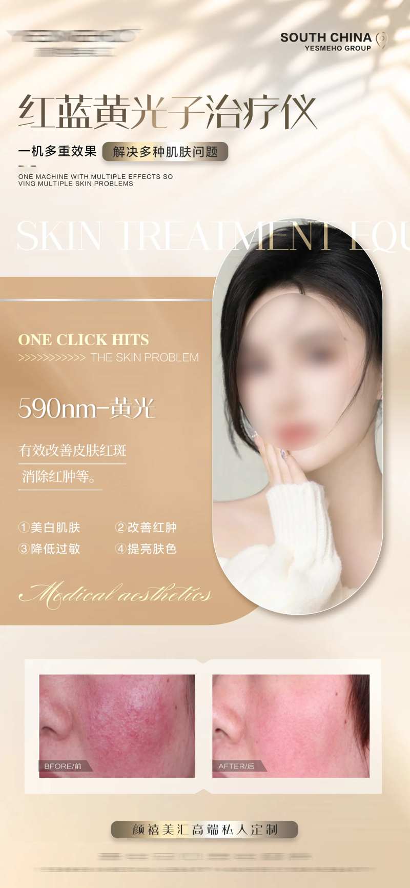 医美红蓝光-采灵感-cailinggan.com