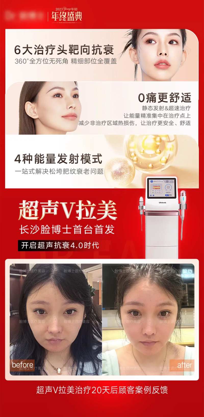 医美超声V拉美海报-采灵感-cailinggan.com