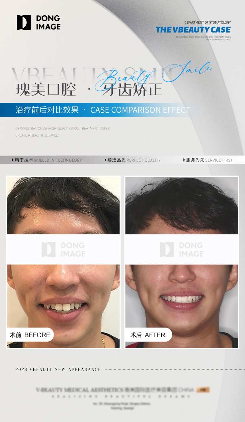 口腔牙科矫正案例对比宣传海报-采灵感-cailinggan.com