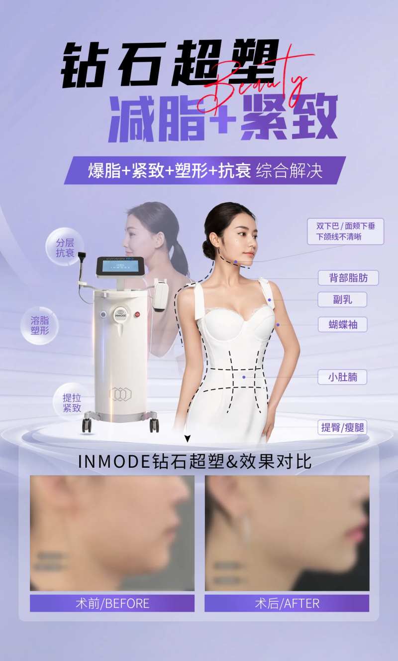钻石超塑瘦身减脂紧致-采灵感-cailinggan.com