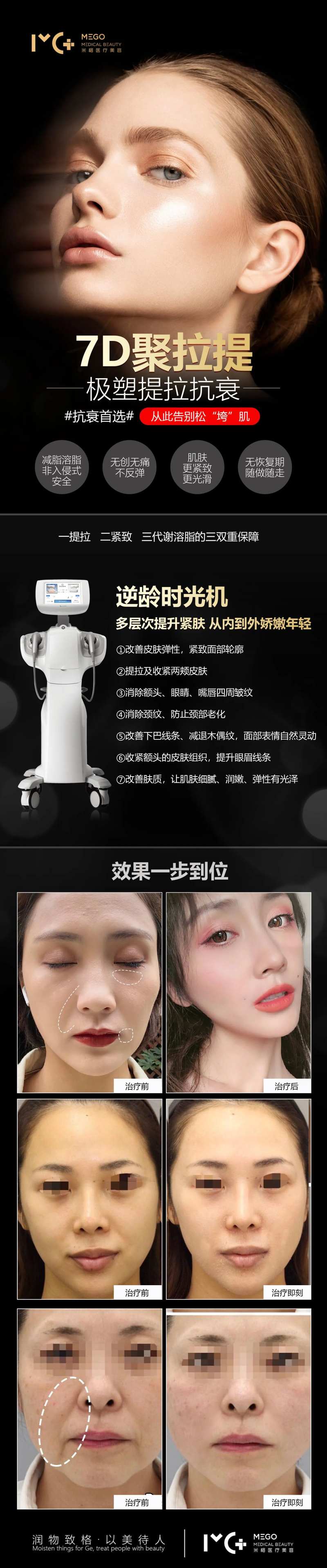 医美7d聚拉提长图海报                                                                                                                                                                                             -采灵感-cailinggan.com