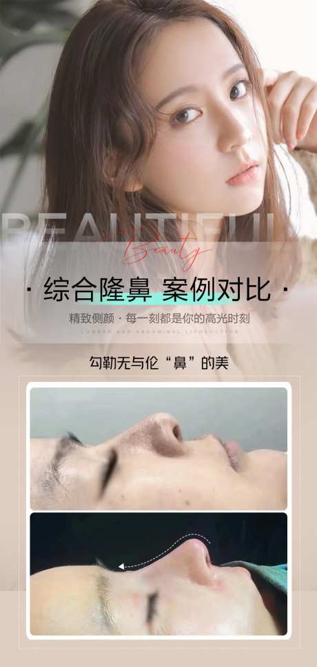 医美隆鼻真人整形案例海报-采灵感-https://www.cailinggan.com/
