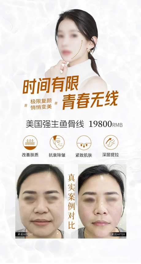美国强生鱼骨线医美海报-采灵感-https://www.cailinggan.com/
