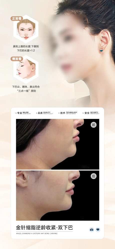 医美双下巴案例对比海报-采灵感-https://www.cailinggan.com/