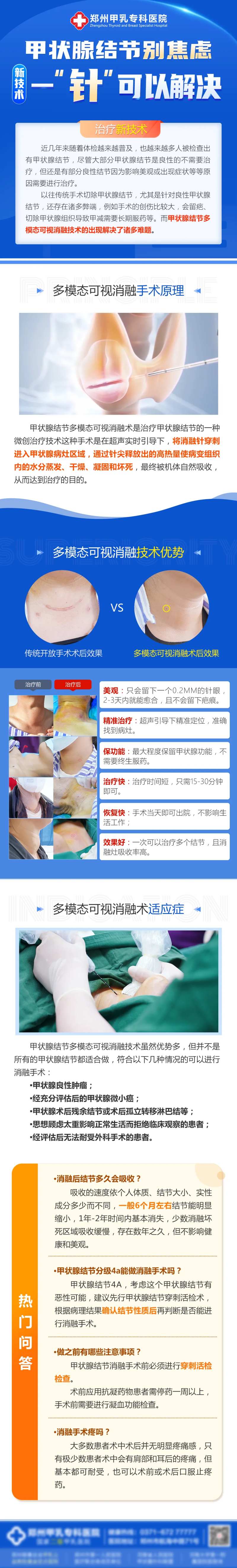 甲状腺结节海报-采灵感-cailinggan.com