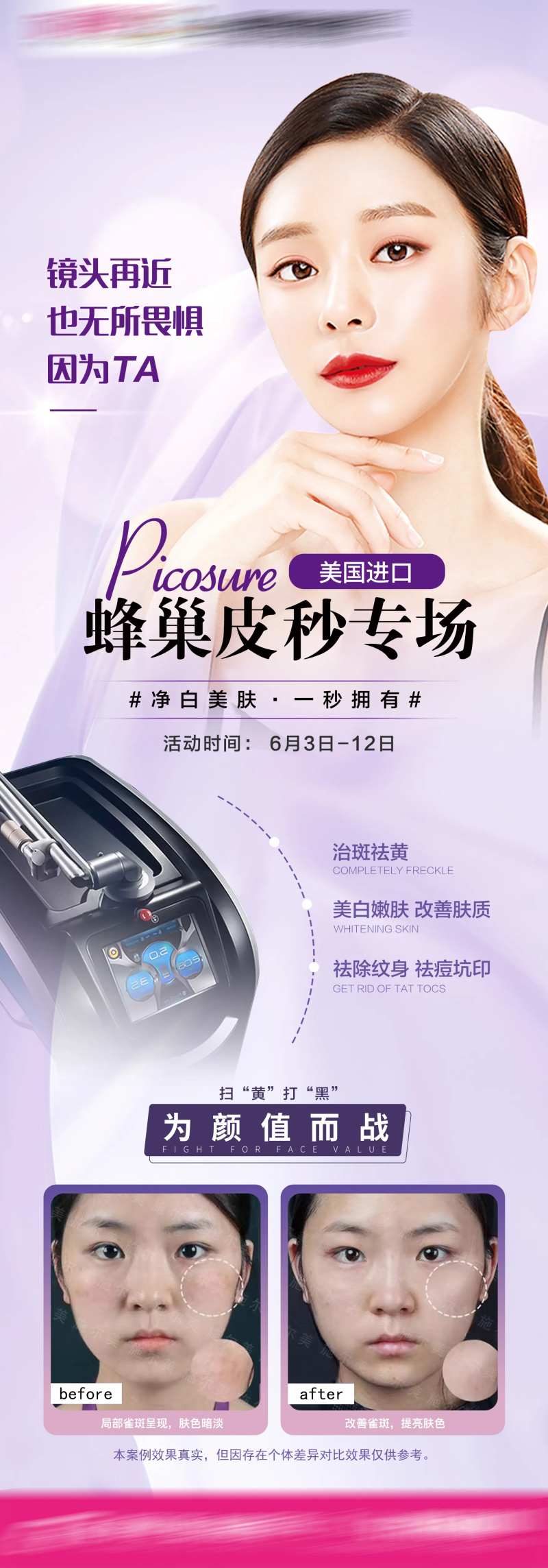 蜂巢皮秒祛斑长图海报-采灵感-cailinggan.com