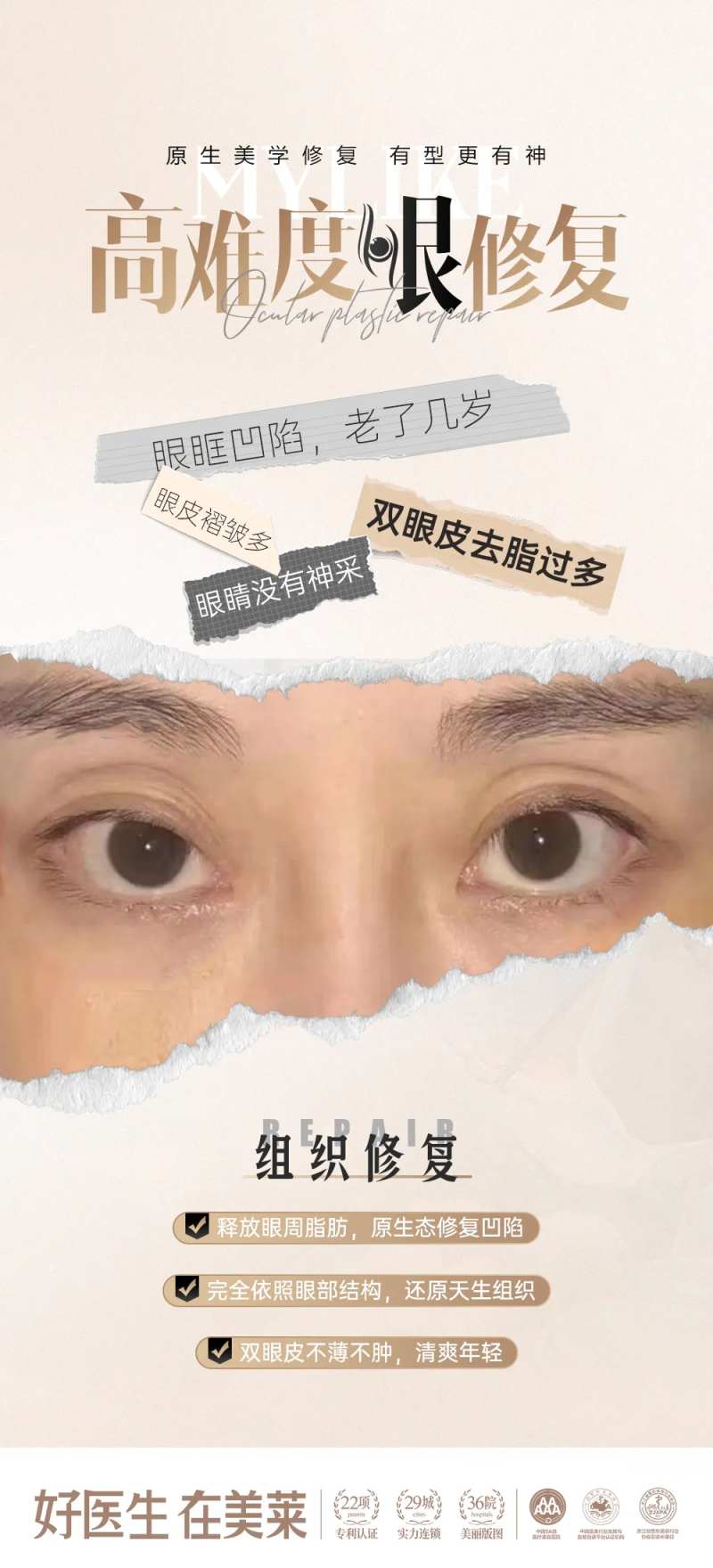 眼修复-采灵感-cailinggan.com