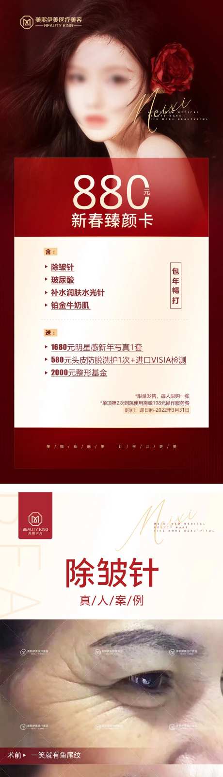 医美卡项海报-采灵感-https://www.cailinggan.com/