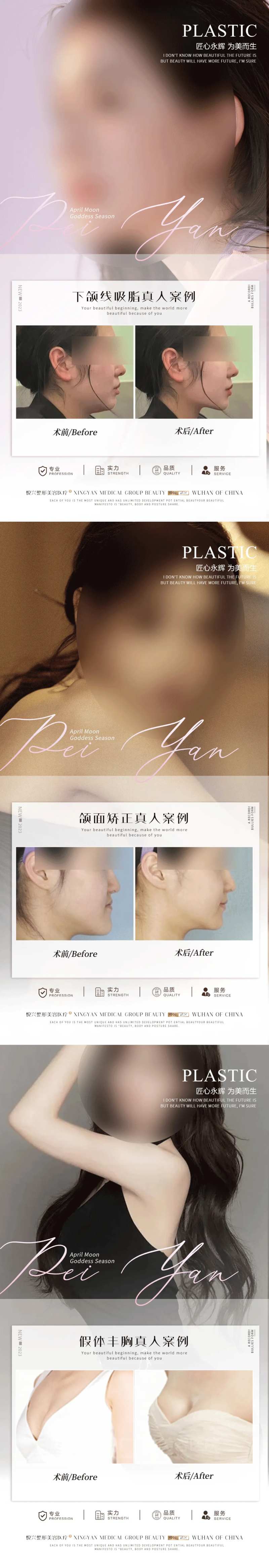 整形真人案例分享集-采灵感-cailinggan.com