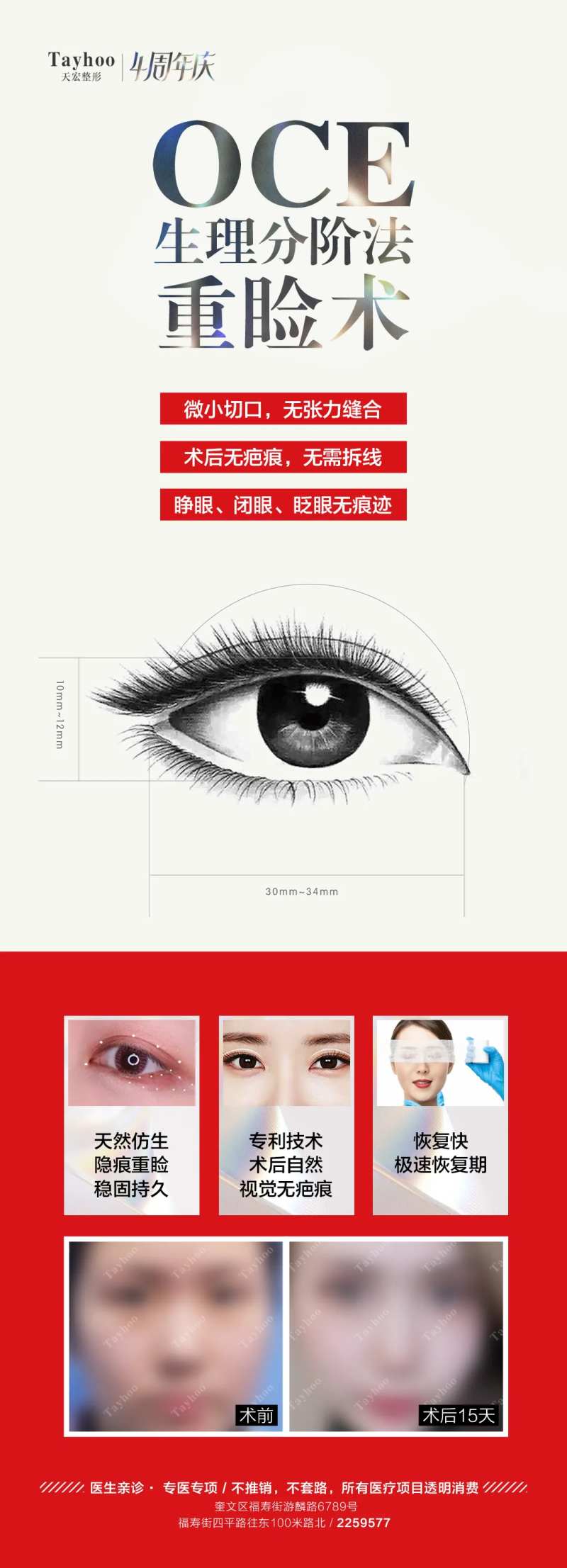 眼整形海报-采灵感-cailinggan.com