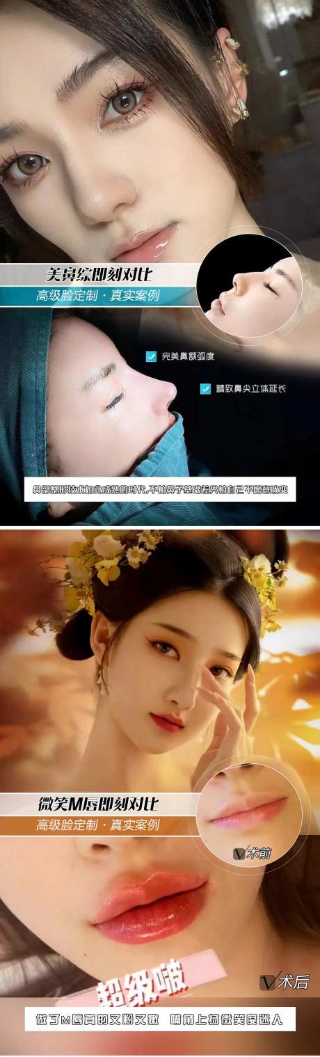 医美对比案例(TIF用PS打开)-采灵感-https://www.cailinggan.com/